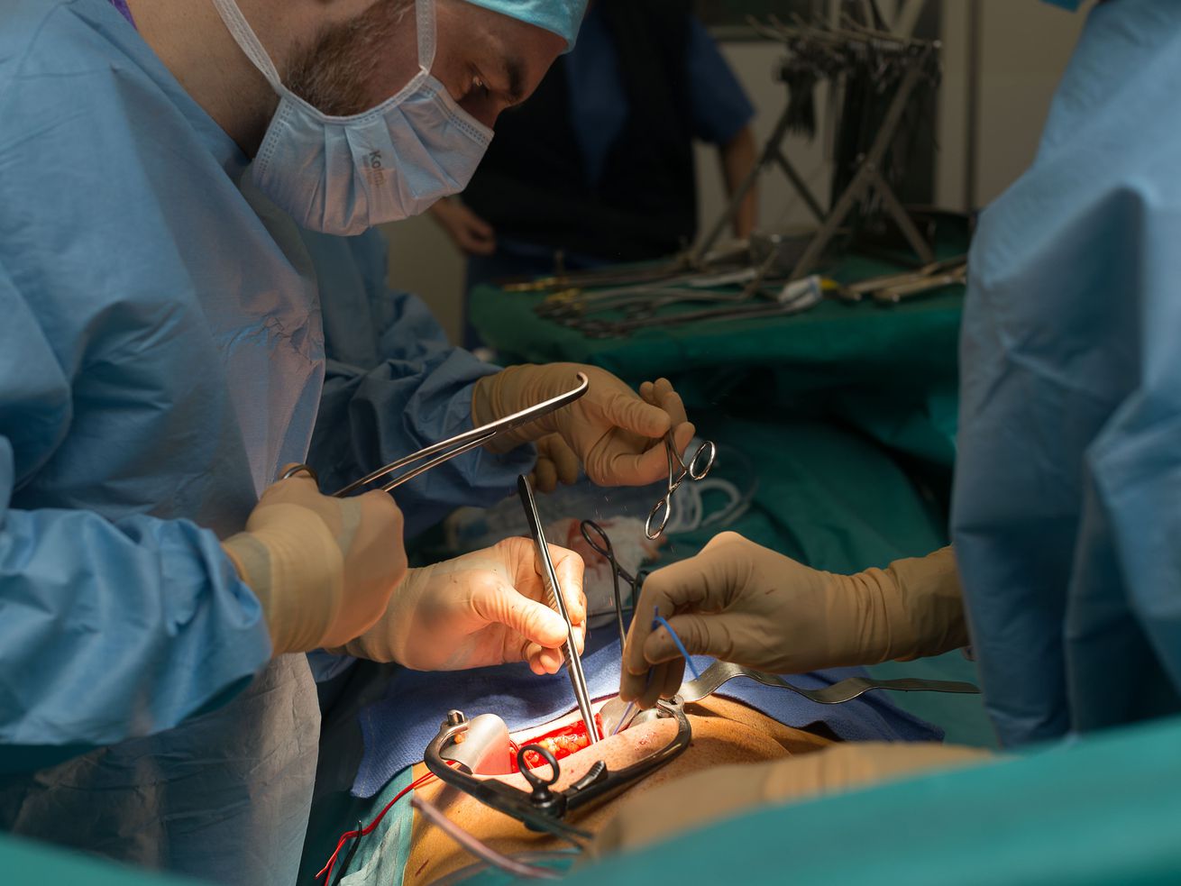 Kidney transplant surgeons operate on a patient.