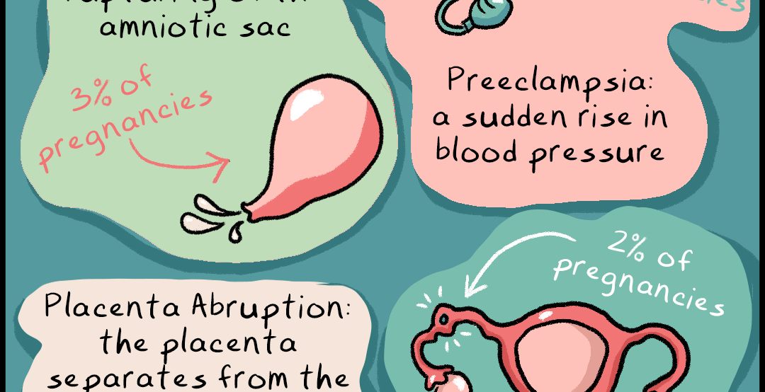 Illustration showing various pregnancy complications. Text reads: 1 in 10 pregnant people develop one of these dangerous complications that may require termination: Preeclampsia, a sudden rise in blood pressure (4% of pregnancies); PPROM, premature rupturing of the amniotic sac (3% of pregnancies); Ectopic pregnancy, a pregnancy that implants outside the uterus (2% of pregnancies); Placenta abruption, the placenta separates from the uterus prematurely (1% of pregnancies)