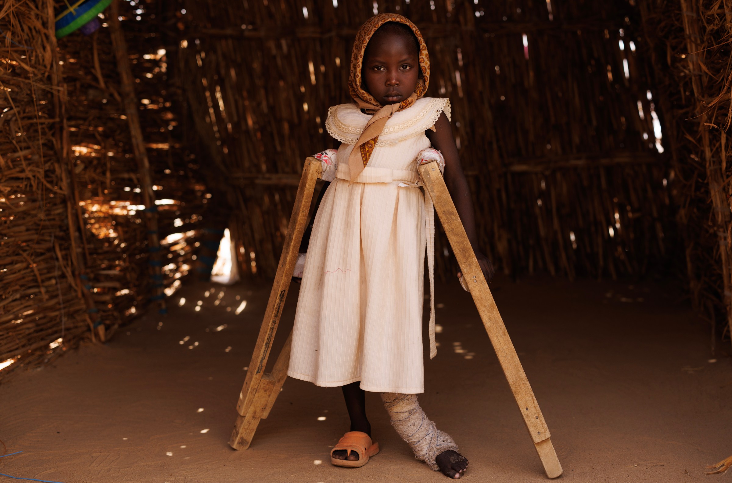 A 5-year-old girl from El Geneina in Darfur, West Sudan was shot in the leg by RSF soldiers.