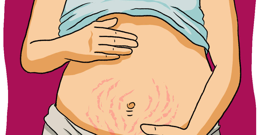 Image: A pregnant woman’s stomach. Text: Prolonging the physical and emotional suffering of miscarriage is a cruel disregard for the health and humanity of pregnant people. 