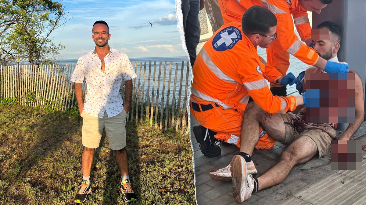 Teacher survives brutal attack abroad