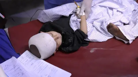 Child with head wrapped in bandage lies on a bed in hospital