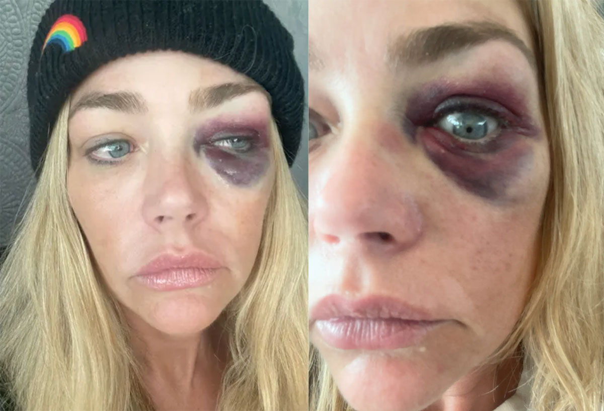 Denise Richards Accuses Aaron Of Domestic Violence