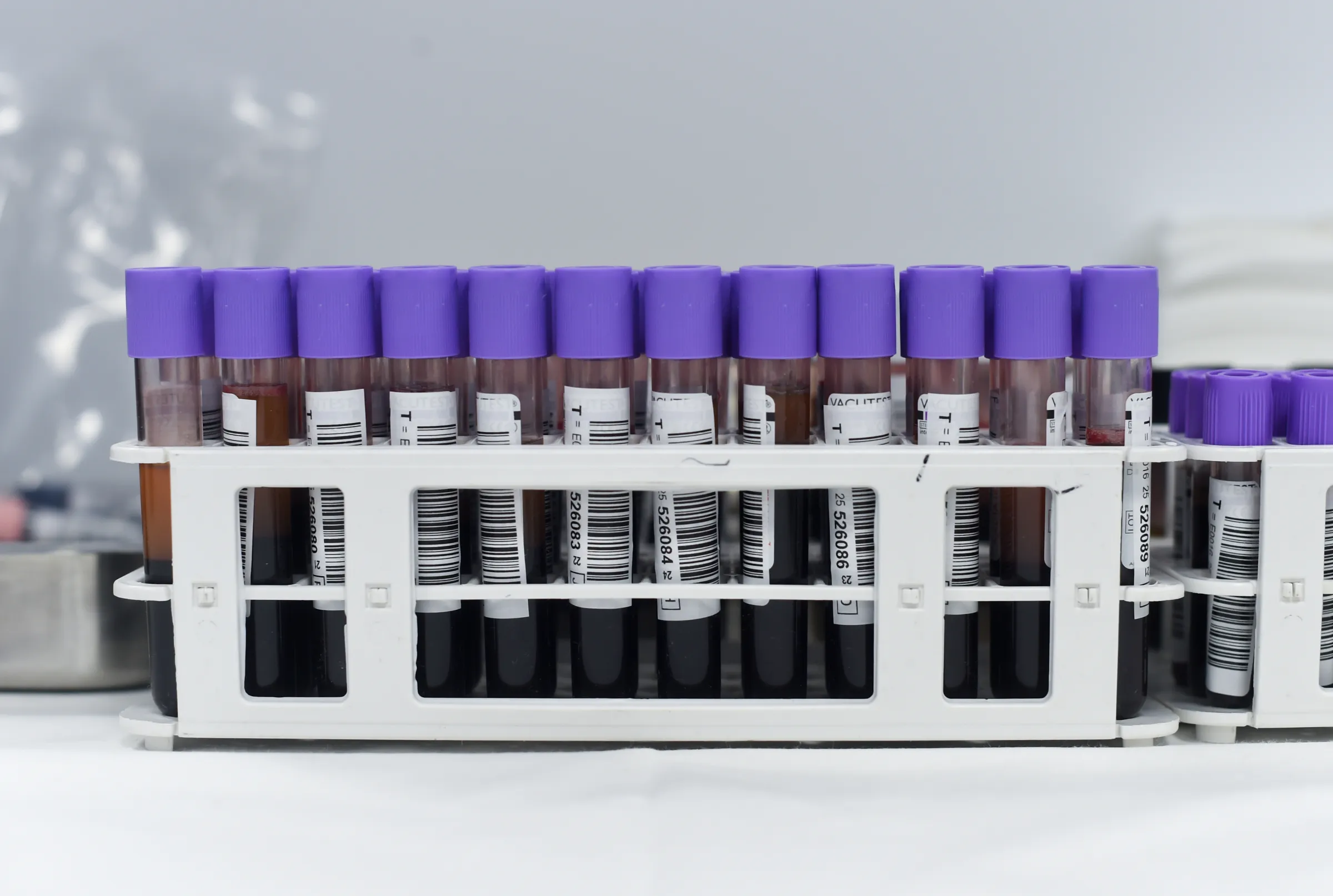Vials of blood in a tray on a table