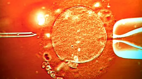 Shutterstock Color light micrograph of a micro-needle (left) about to inject human sperm into a human egg cell (centre) being held in place by a pipette (right). IVF treatment.
