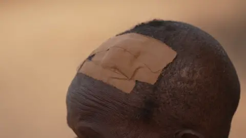 BBC A close up of the top of someone's head with a large plaster clearly see on the top.