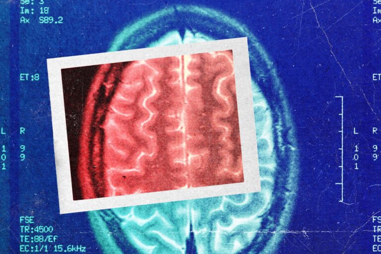 Does Depo-Provera Cause Brain Tumors? How To Read the Research