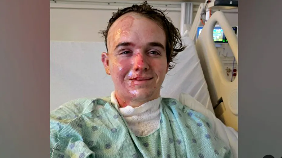 Jacob Smith smiling in hospital gown