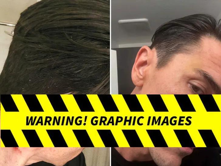 Tom Sandoval Alleged Injuries From Victoria Lee Robinson