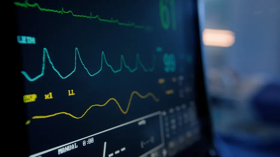 Vital signs monitor displaying heart rate and EKG readings in hospital ICU