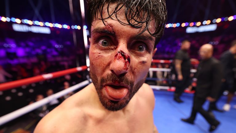 Josh Kelly (white shorts) wins his IBF World Super Welterweight Title contest against Caoimhin Agyarko and shows cut nose during the Anthony