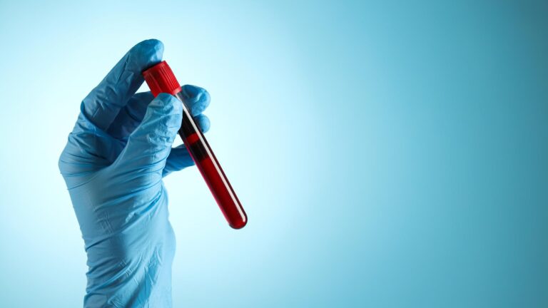 Who Should Get a Blood Test for Alzheimer's Disease?