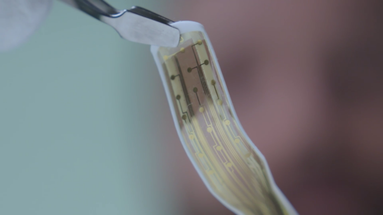 Graphene Brain Implant Robot Follows Curves to Targets Conventional DBS Frames Cannot Reach