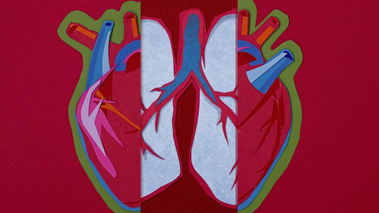 Normalcy Bias Prevented Me from Recognizing My Daughter’s Heart Failure