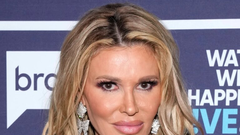 Brandi Glanville Undergoing Surgery To Remove Facial Gunk and Organisms