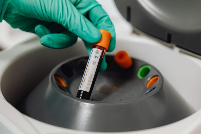 Platelet-Rich Plasma (PRP) Therapy for Erectile Dysfunction